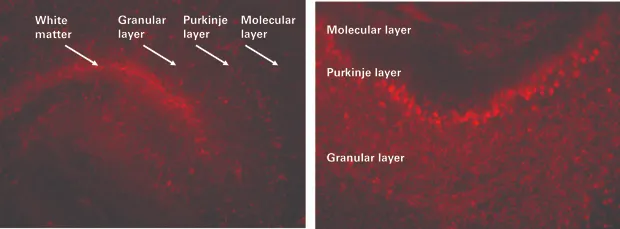 Simple but effective siRNA delivery