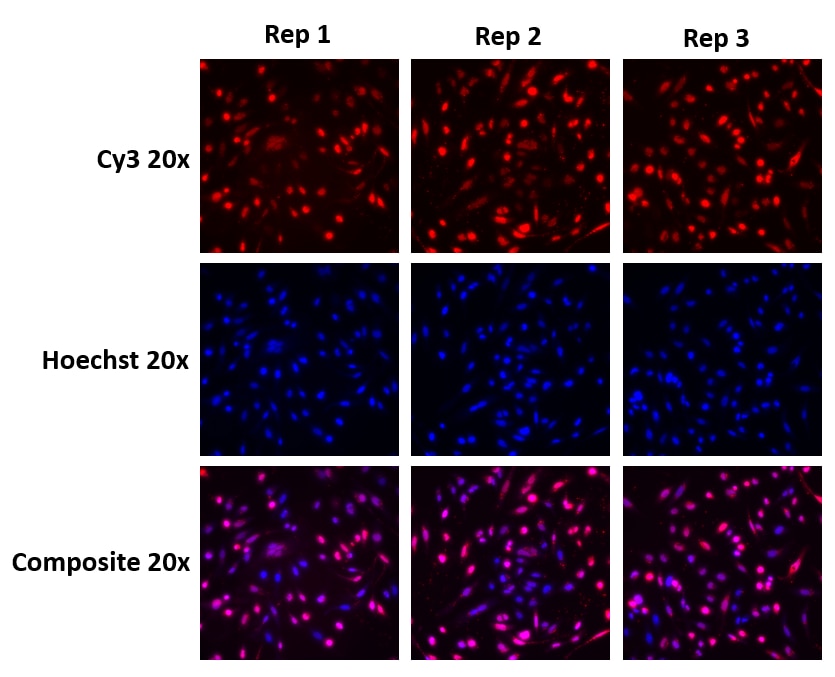 Cy3-labeled miRIDIAN microRNA hairpin inhibitor transfection control allows for qualitative evaluation of transfection