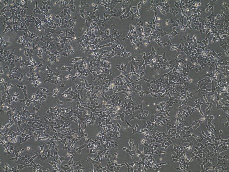 Horizon Discovery's Cas9 stable cells microscope image of Horizon Cas9 stable cells